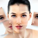 Comparing Skin Whitening Options in Chennai PRP vs. Top Skin Lightening Treatments for a Brighter Complexion